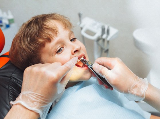 a child undergoing tooth extractions in Allen